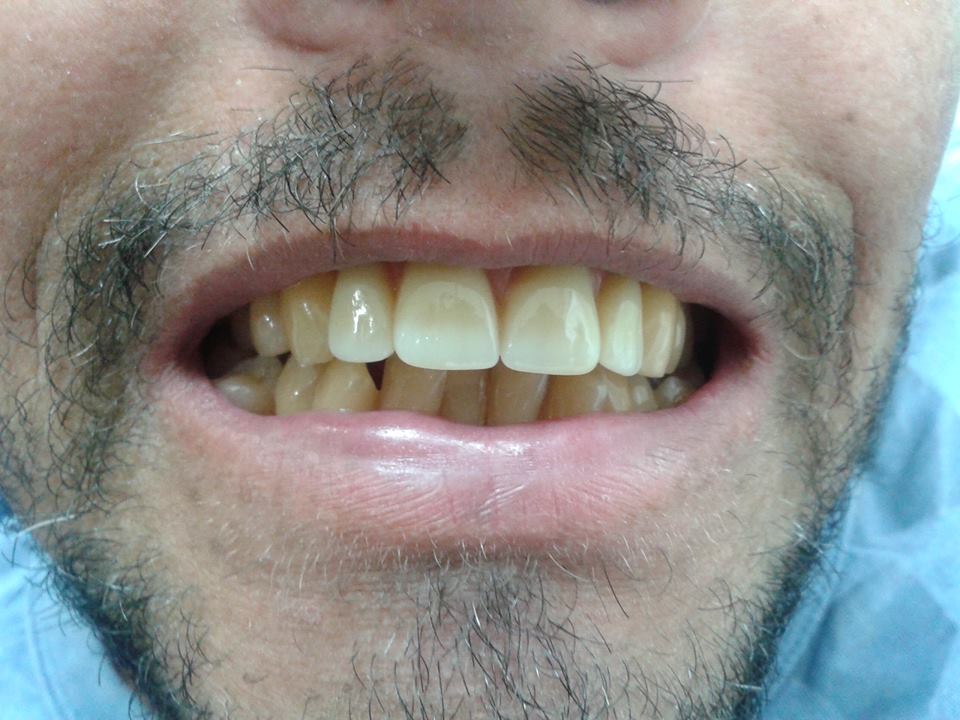 12248893_1040432016020033_4032119_n
